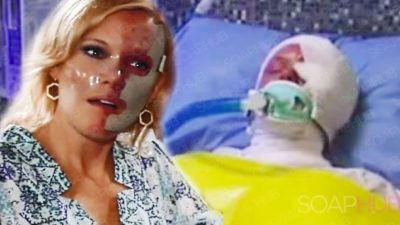 OK, General Hospital, We Have A Question–Where Are Ava’s Burns?